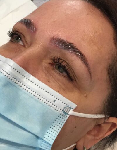 Brow-Lamination-During-Stage2-Treatment