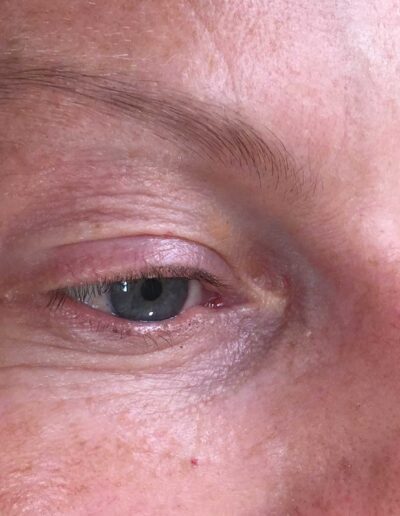 Lash-Lift-and-Tint-and-Henna-Brow-Treatment-before